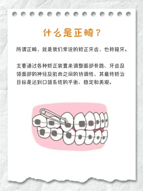 口腔正畸矫正治疗流程具体包含哪些步骤?-图2 口腔正畸矫正治疗流程具体包含哪些步骤?-图2