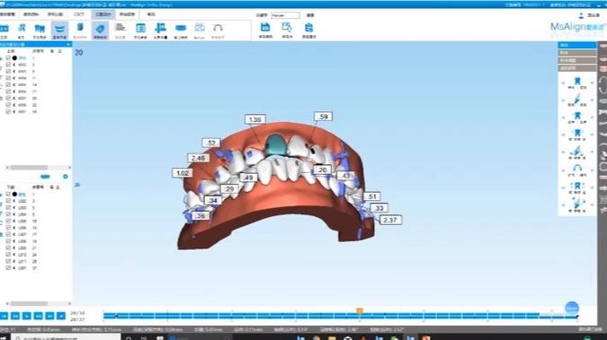 隐形正畸软件系统开发面临哪些关键技术难题？-图1