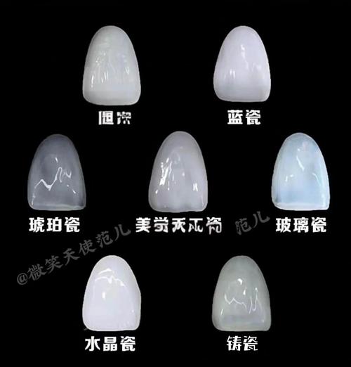 冰晶正畸与陶瓷矫正器的主要区别有哪些？-图1