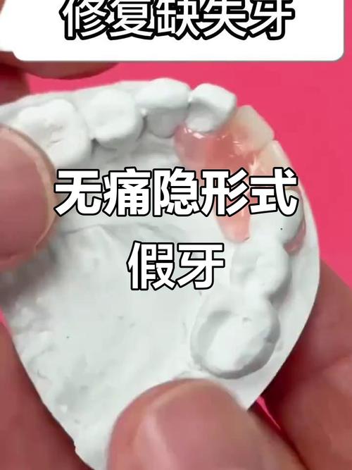 广州公益种牙假的消息是否属实？是真的吗？-图3