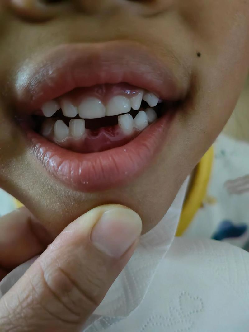 2025种一颗牙，这些新趋势你准备好了吗？-图2