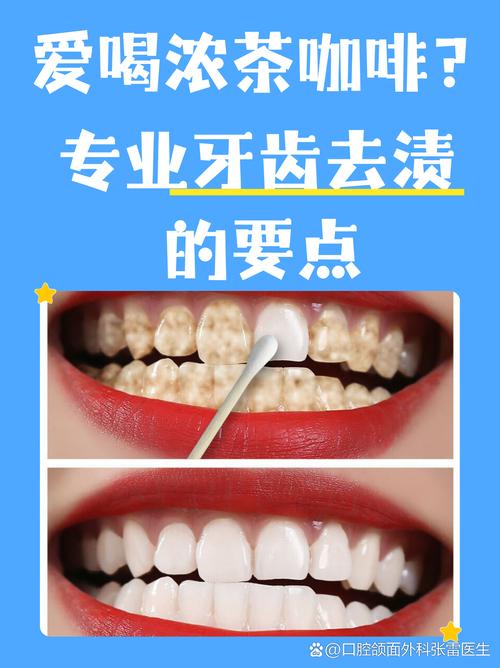 不同蛀牙情况,牙齿去腐的最佳方法是什么?-图2 不同蛀牙情况,牙齿去腐的最佳方法是什么?-图2