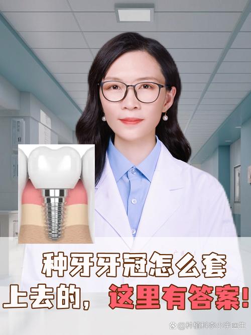 冠延长术后，种植牙修复是否还能顺利进行？-图2