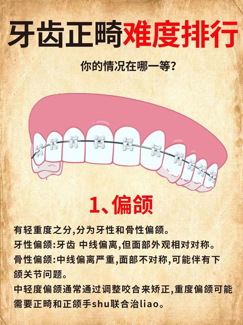 正畸治疗中度矫正力量具体是多少？-图2