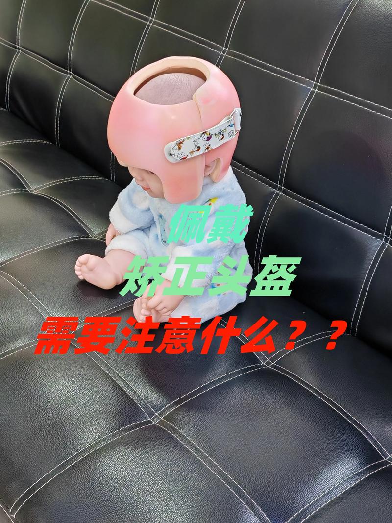 每天带几个小时正畸帽-图2 每天带几个小时正畸帽-图2