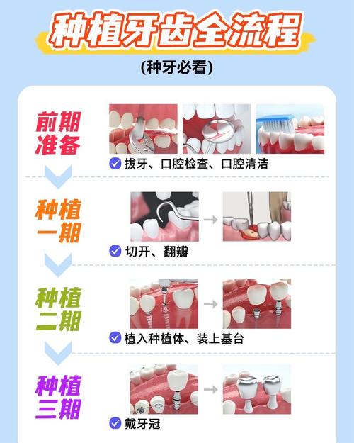 种牙的过程和步骤具体包含哪些关键环节？-图1