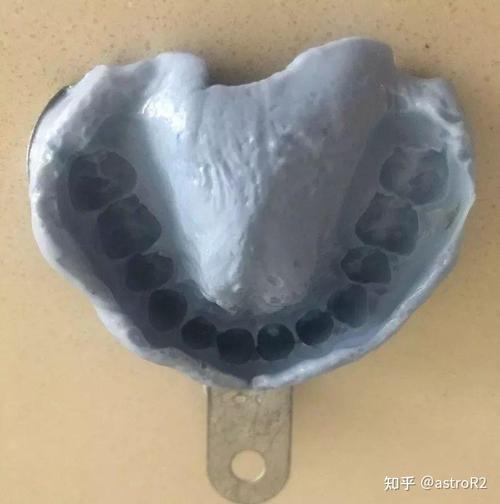 北大口腔正畸失败案例,问题究竟出在哪?-图3 北大口腔正畸失败案例,问题究竟出在哪?-图3