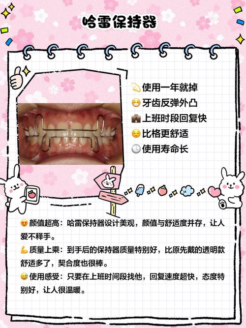正畸弹性牵引圈怎么带?详细步骤与操作方法指南-图2 正畸弹性牵引圈怎么带?详细步骤与操作方法指南-图2