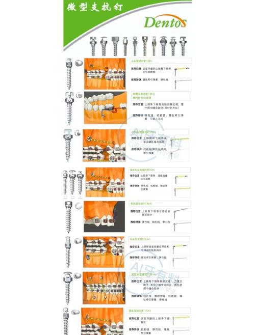 正畸种植支抗钉的副作用具体有哪些常见表现？-图2