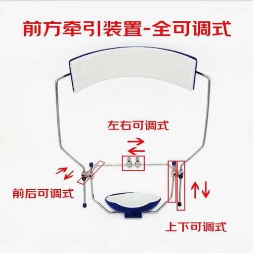 正畸反颌口外牵引装置适用于哪些反颌类型?-图3 正畸反颌口外牵引装置适用于哪些反颌类型?-图3