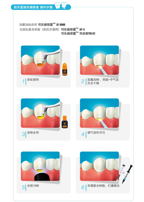 口腔材料使用方法的关键步骤和注意事项有哪些？-图2