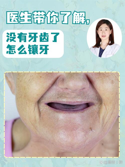 没有牙根还能修复吗？具体有哪些方法？-图2