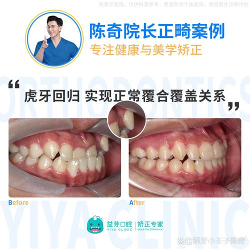 额面外科是否属于正畸科，还是另有归属？-图2