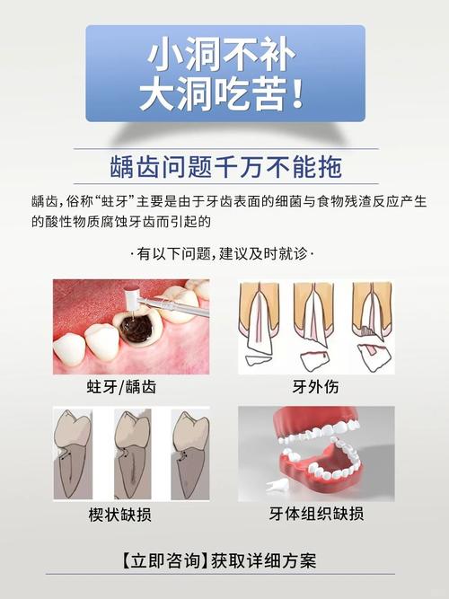 浅龋最早诊断方法，如何实现最早期龋坏的精准识别？-图2