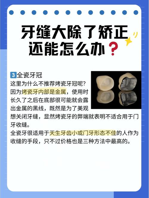 牙缝大正畸矫正，有哪些科学有效的矫正方法？-图1