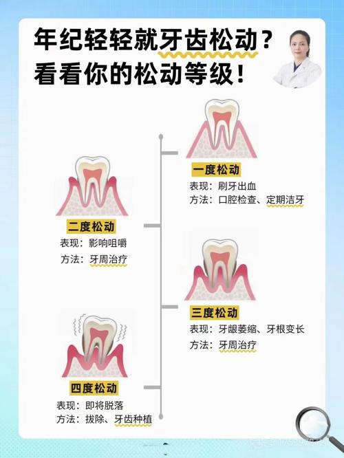 种植牙松动会掉落吗?脱落风险大吗?-图1 种植牙松动会掉落吗?脱落风险大吗?-图1