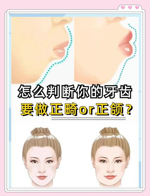 口腔外科与正畸科的区别体现在哪些方面？-图1