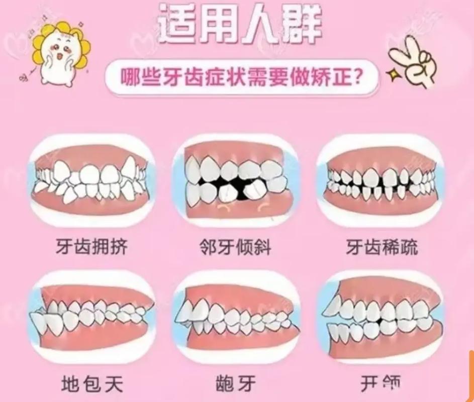 口腔外科与正畸科的区别体现在哪些方面？-图2