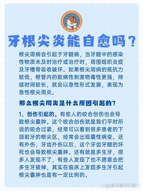 牙尖治疗方法有哪些？如何有效治疗牙尖问题？-图2