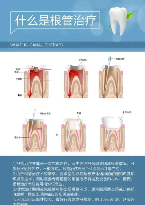 牙齿全科治疗方法有哪些常见治疗方式？-图2