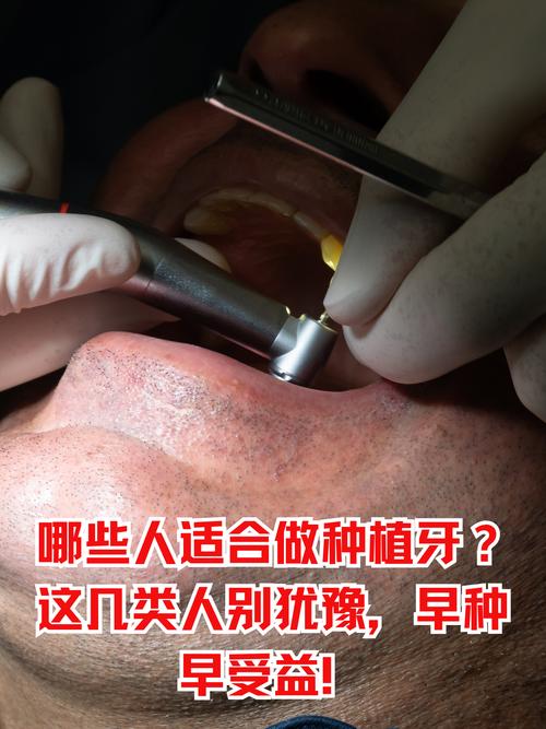 口腔骨尖的治疗方法有哪些？哪种更有效？-图3