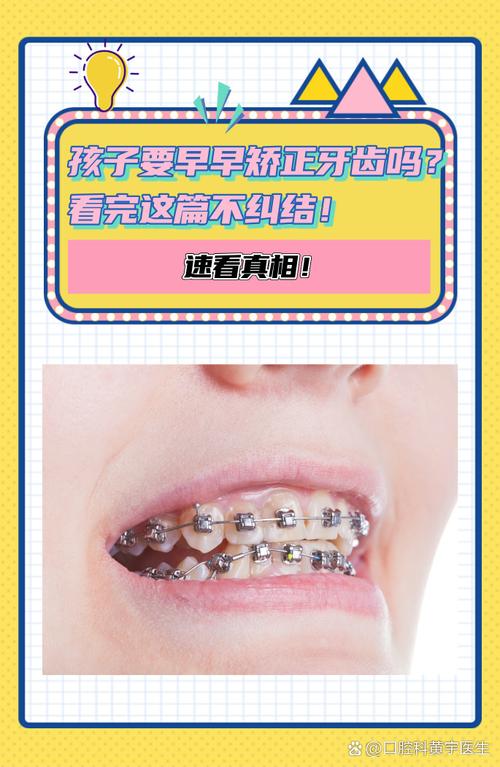 儿童正畸是否必须拔牙？关键看这些情况-图1