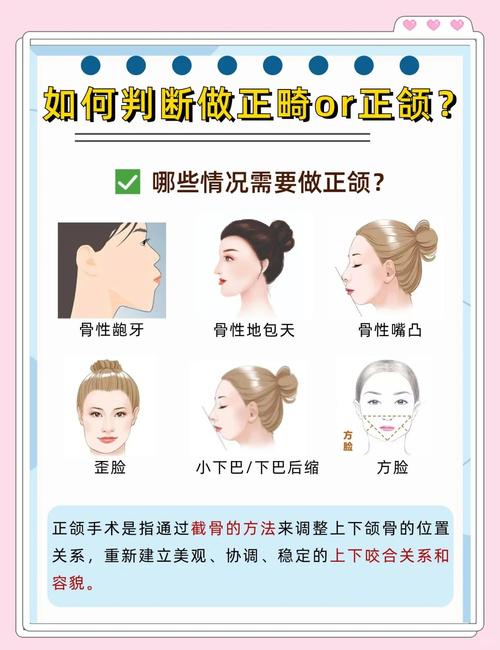 口腔正畸会影响颞下颌关节健康吗？-图3