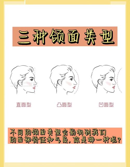 正畸侧貌面型分类标准-图1