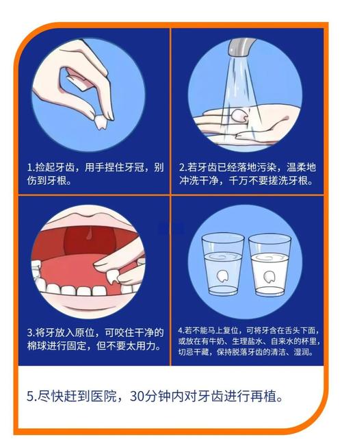 脱位牙如何正确保存?黄金时间要注意什么?-图1 脱位牙如何正确保存?黄金时间要注意什么?-图1