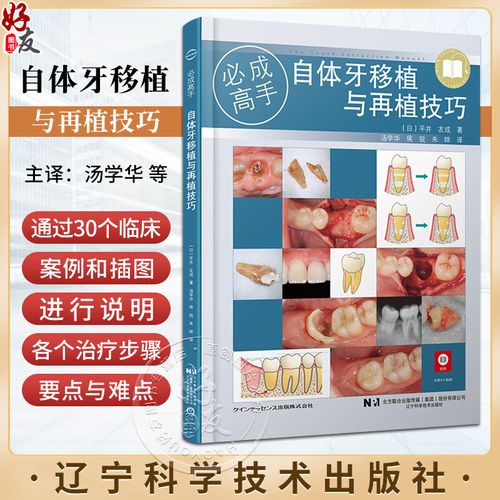 自体牙移植是先种牙根还是先种牙冠？-图1