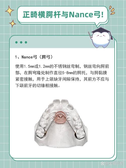 正畸弓形5的形状具体是什么样的呢？-图2