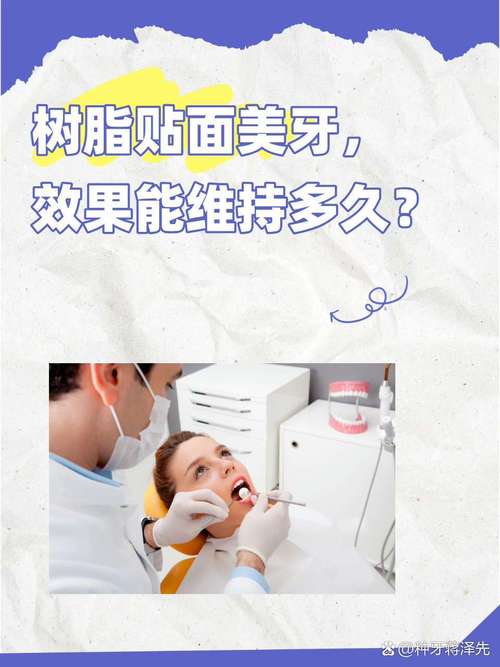 树脂贴面制作方法的详细步骤和要点有哪些？-图1