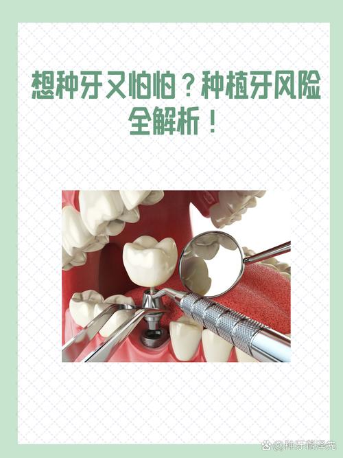 种牙手术存在哪些潜在风险?-图1 种牙手术存在哪些潜在风险?-图1