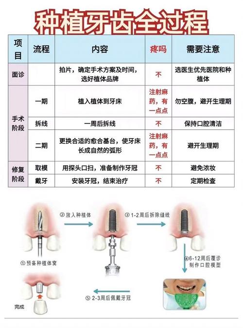 种牙手术从哪开刀-图1