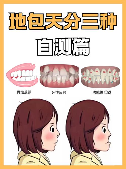 错合畸形分类方法的主要类型有哪些？-图3