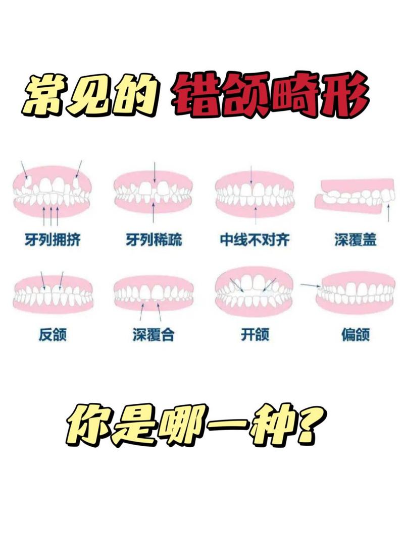 错合畸形分类方法的主要类型有哪些？-图1