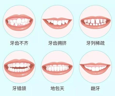 错合畸形分类方法的主要类型有哪些？-图2