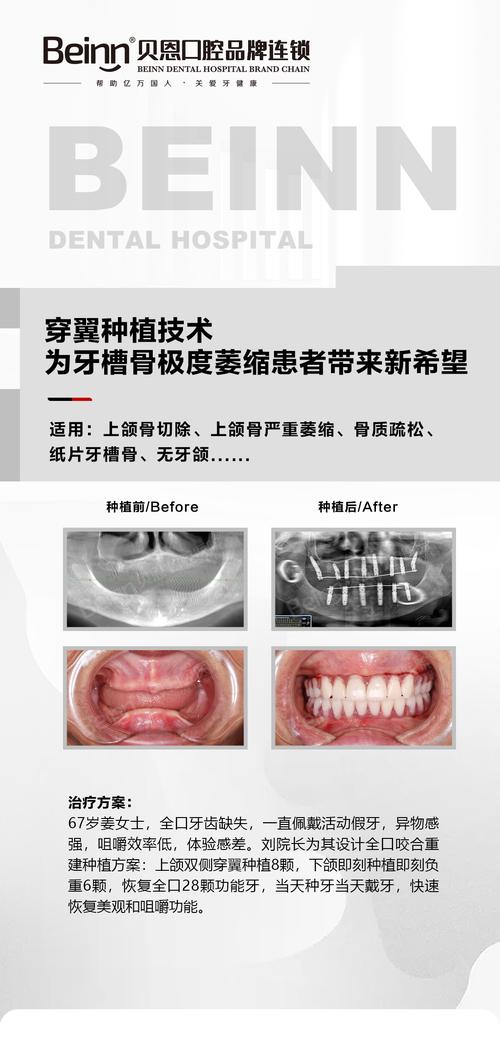 种牙难度大的案例，究竟难在哪些关键环节？-图2