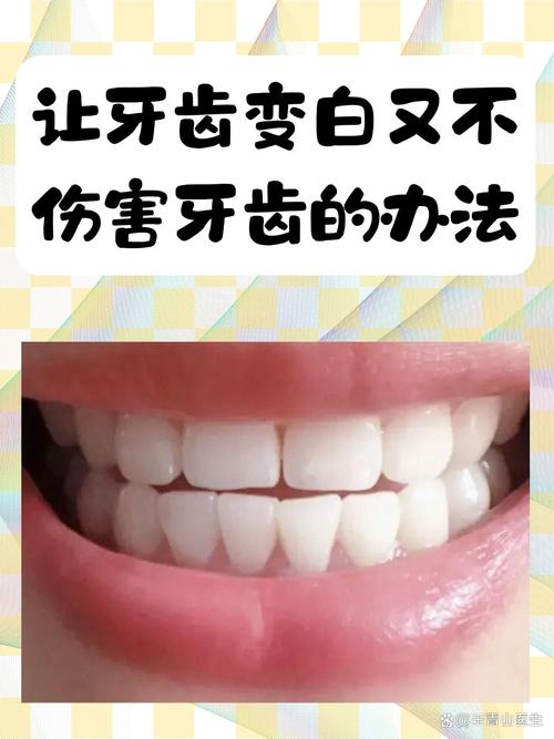 遗传牙齿天生偏黄,有没有安全有效的变白方法?-图1 遗传牙齿天生偏黄,有没有安全有效的变白方法?-图1