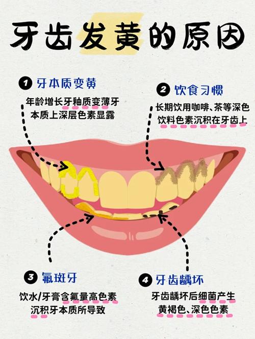 遗传牙齿天生偏黄，有没有安全有效的变白方法？-图3