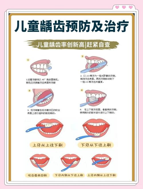 儿童深龋治疗有哪些常用的有效治疗方法？-图1