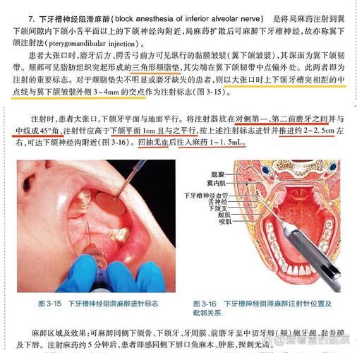 牙科打麻药是怎么打的？具体方法步骤是什么？-图1