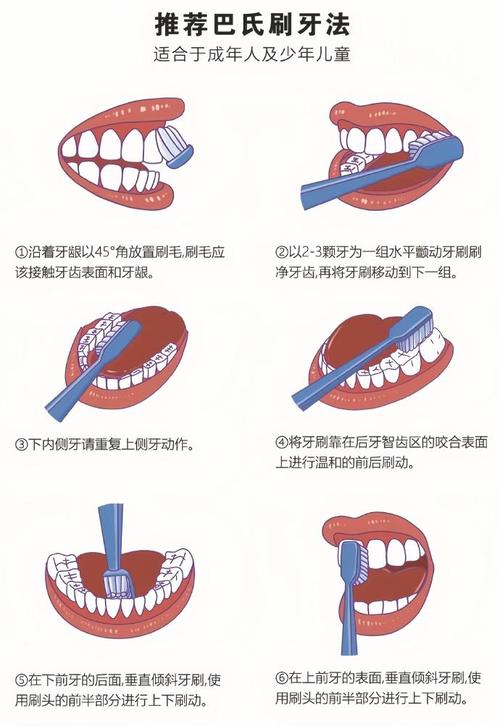 戴牙套后，正畸牙刷牙的正确方法是什么？-图1
