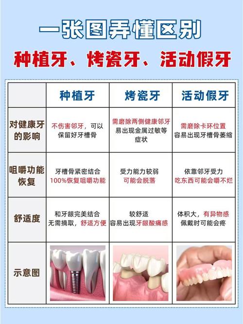 种完牙可以活动么-图2