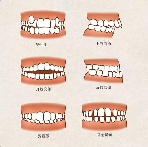下颌牙齿排列方法-图2