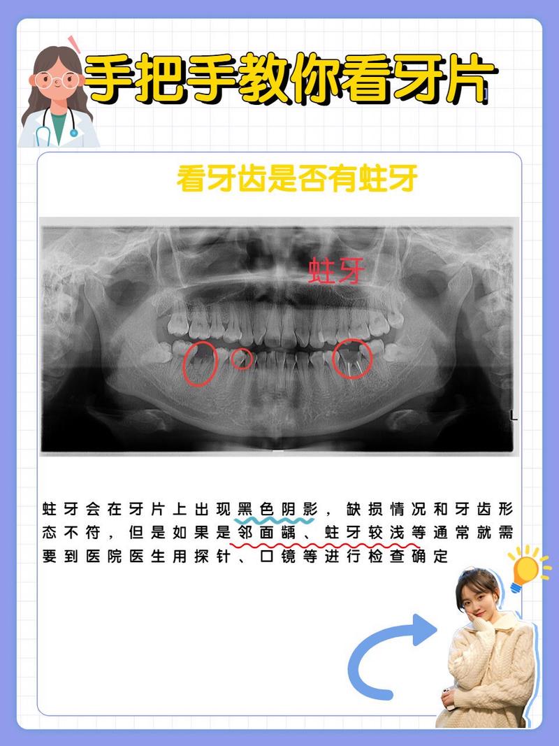 牙科拍片有哪些常用方法？各有何优势？-图3
