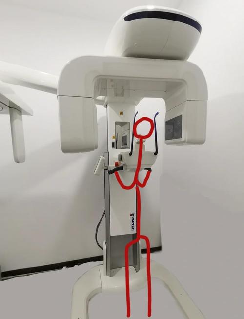 牙科拍片有哪些常用方法？各有何优势？-图1