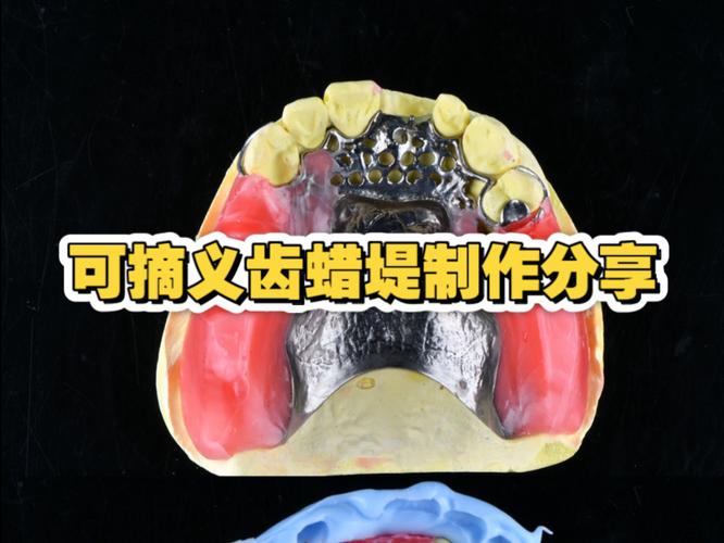 活动义齿冲胶的正确操作步骤是什么？-图2