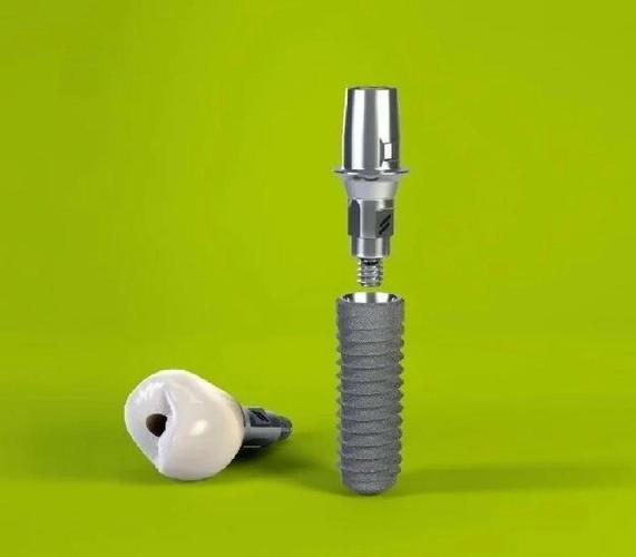 种牙材料会影响核磁共振检查吗？-图2