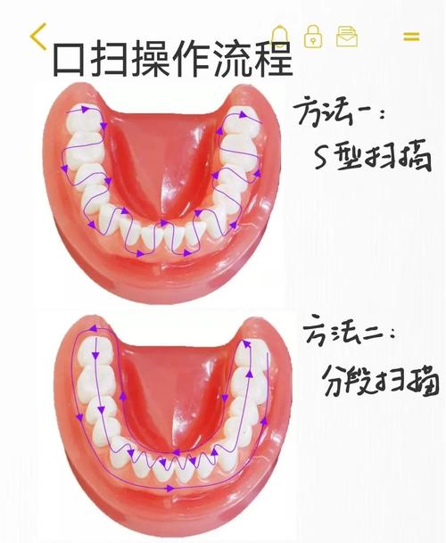 口腔手车如何正确启动？操作步骤有哪些？-图1